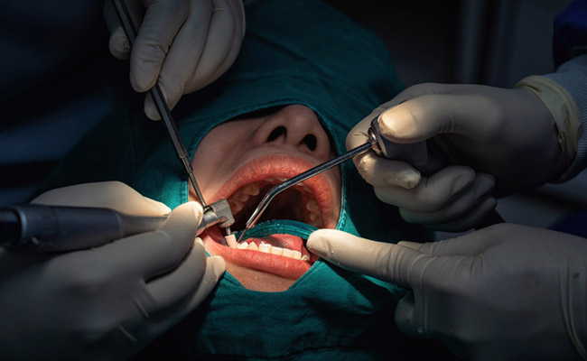 Dentists performing deep cleaning on patient.