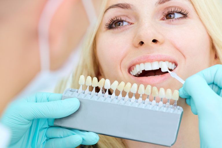 Dentist comparing veneer colors with a patients teeth.