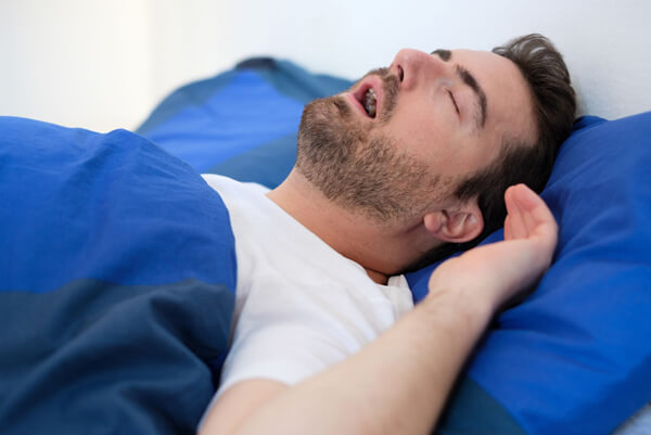 What are oral appliances for sleep apnea. Man pictured with awkward breathing.