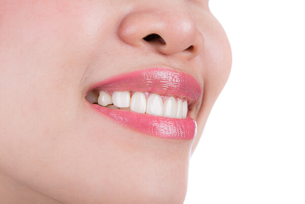 Kor whitening removes stains and discoloration from natural teeth. The results are stunning.