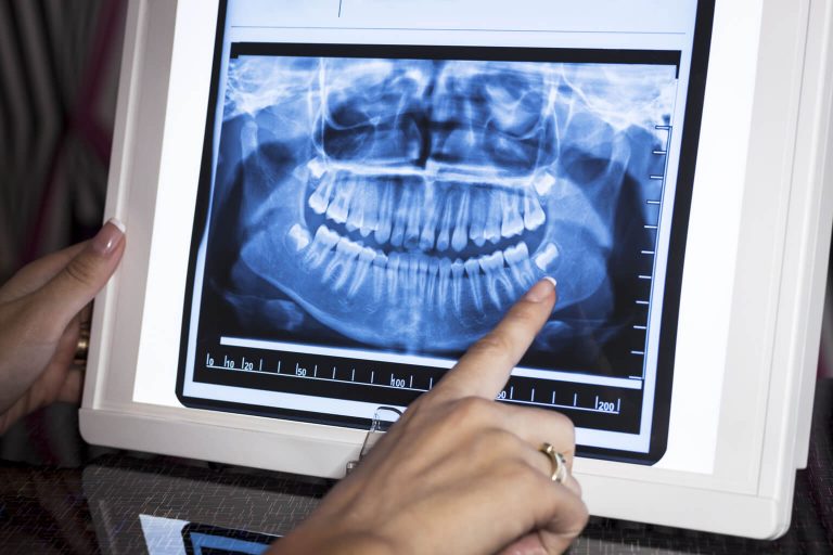 Image of a dentist reviewing a dental x-ray.