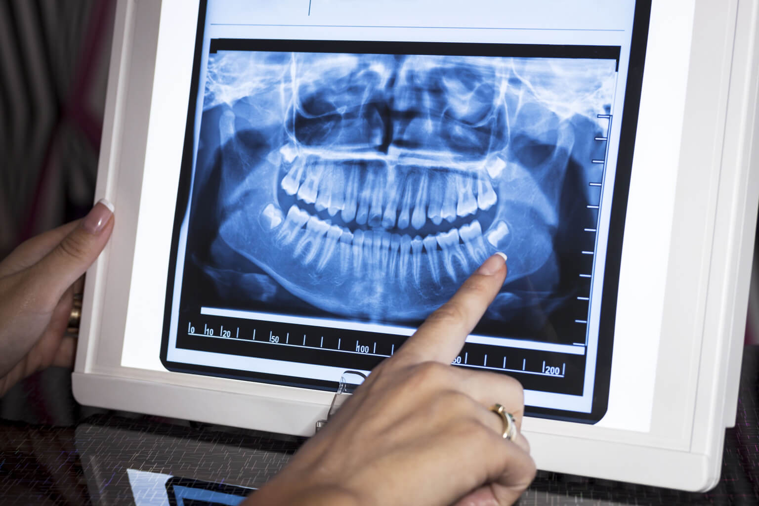 Dentist examining a patients x-ray
