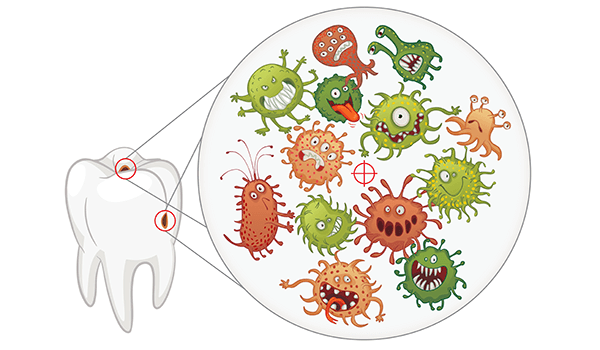 Illustration showing dental bacteria