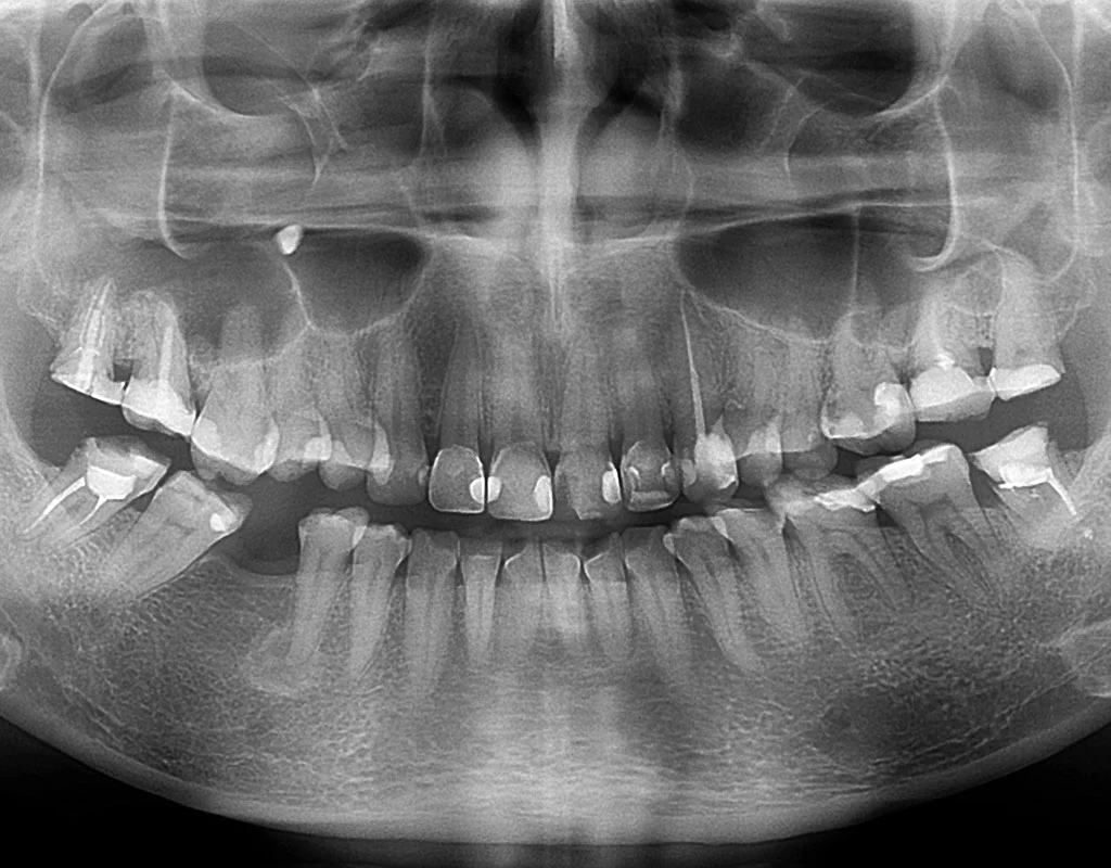 dental-xrays
